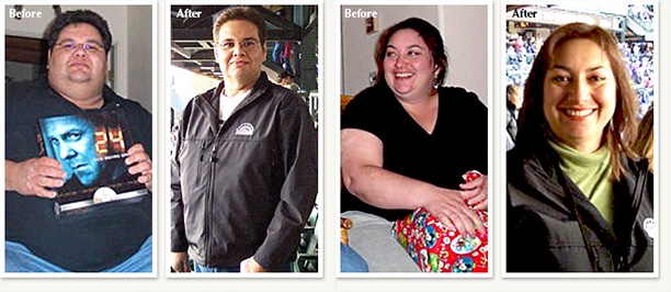 Chris and Ana before and after medical weight loss pictures