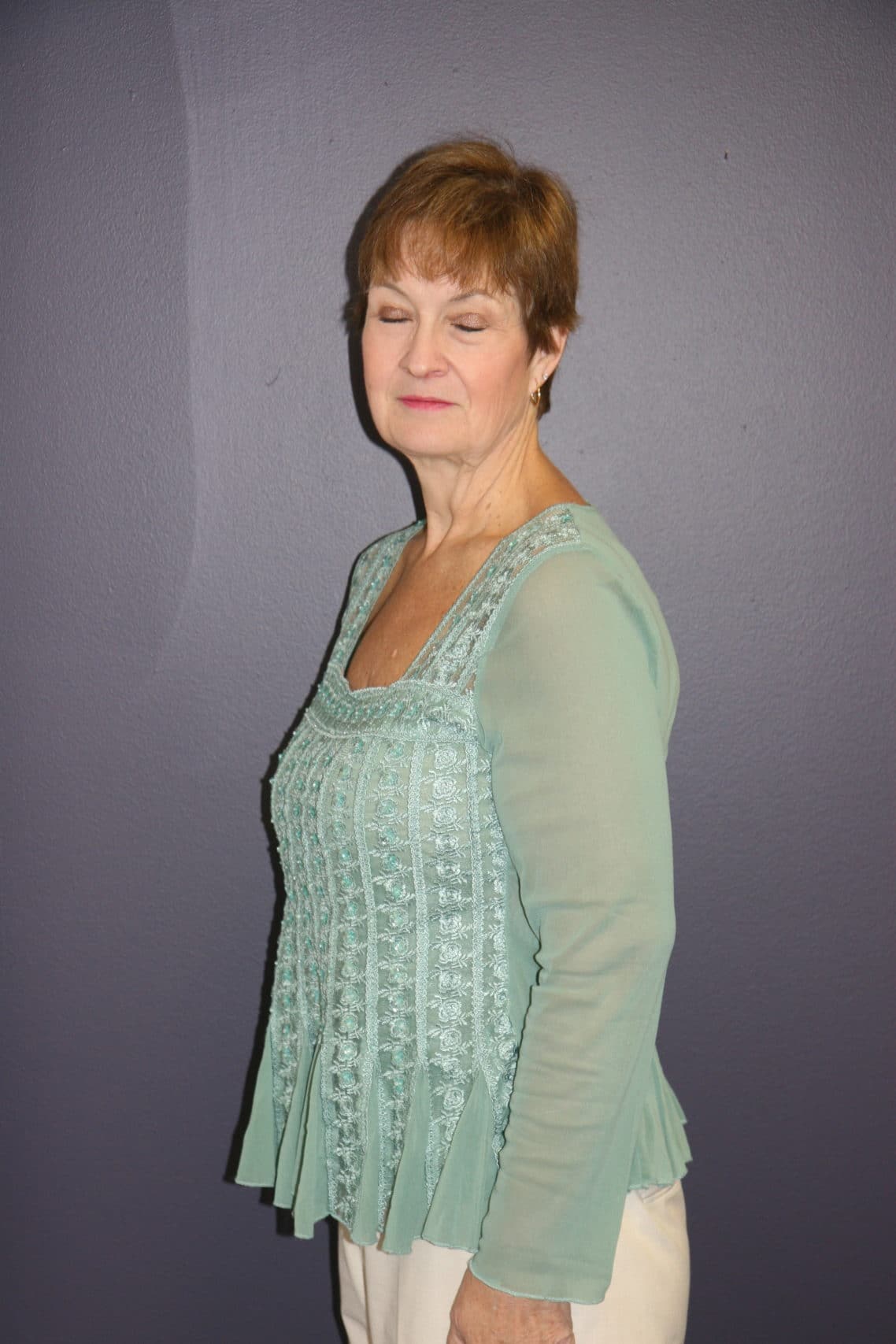 Peggy after weight loss