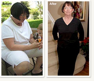 Nancy: 39 lbs Weight Loss