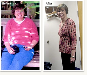 Teresa before and after losing 68 pounds at Clinical Nutrition Center in Denver Colorado