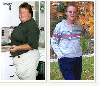 Claudia pictures before and after 106 pound medical weight loss with Dr Ethan Lazarus in Denver Colorado