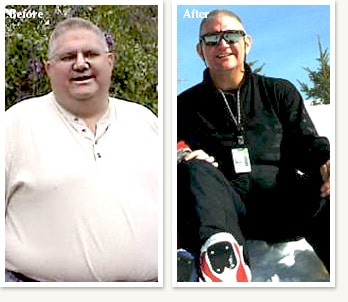 Craig before and after 143 pound medical weight loss journey with Dr Ethan Lazarus in Denver Colorado