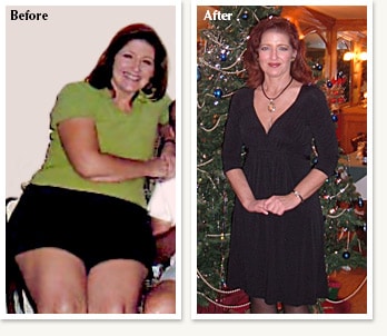 Jana before and after medical weight loss of 58 pounds in Denver Colorado