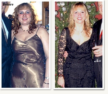Jeannie before and after medical weight loss with Dr Ethan Lazarus at Clinical Nutrition Center in Denver Colorado