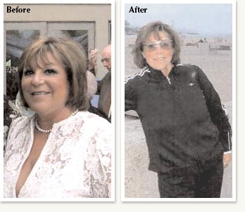 Linda before and after medical weight loss of 60 pounds with Dr Ethan Lazarus in Greenwood Village Colorado