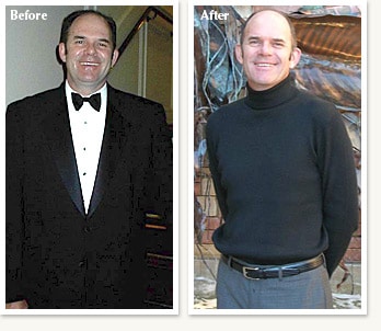 Peter before and after 48 pound medical weight loss journey with Dr Ethan Lazarus in Denver Colorado