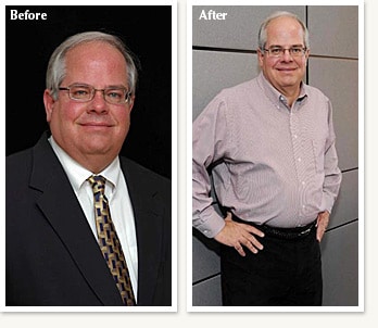 Steve before and after 50 pound medical weight loss journey with Clinical Nutrition Center in Denver Colorado