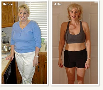 Teri: before and after 82 pound medical weight loss with Dr Ethan Lazarus in Denver Colorado