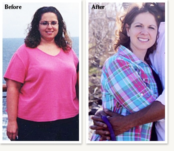 Enid before and after medical weight loss with Clinical Nutrition Center in Denver Colorado