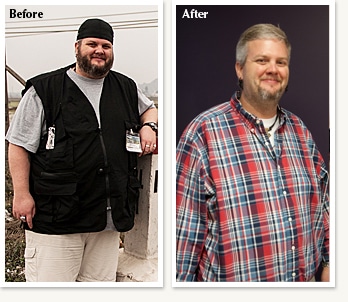 Pete before and after losing weight with Dr Ethan Lazarus in Denver Colorado
