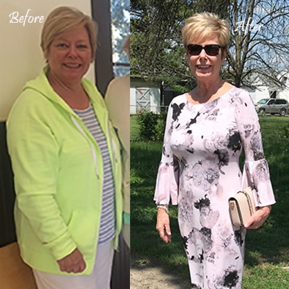 Cheri before after losing weight