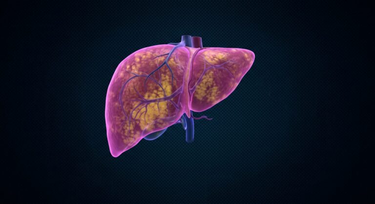 | Clinical Nutrition Center Fatty Liver Disease (MASH)
